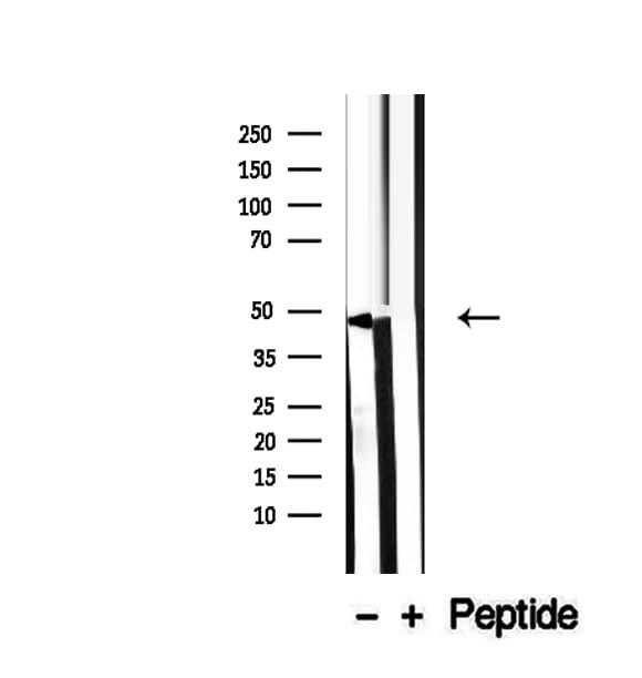 SUN5 / SPAG4L Antibody