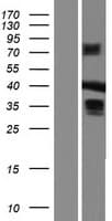MBNL3 Protein (Over-Expression Lysate Myc-DDK (Flag))