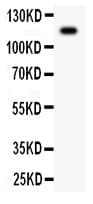 Polyclonal Rabbit anti-Rat Complement C5 Antibody (aa1-77, IHC, WB)