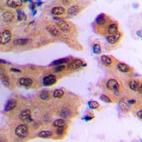 Polyclonal Rabbit anti-Human FOS / c-FOS Antibody (pS362, IHC, WB)