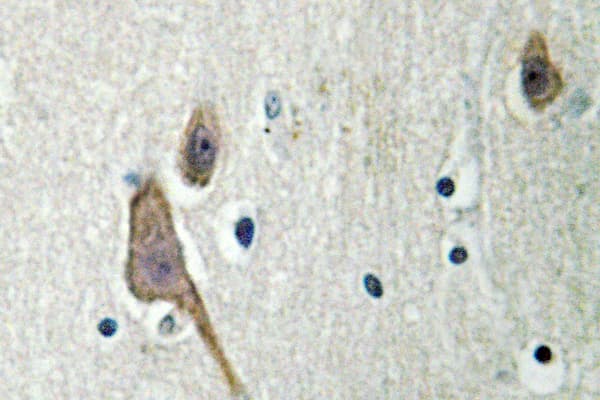YWHAZ / 14-3-3 Zeta Antibody (Ala79)