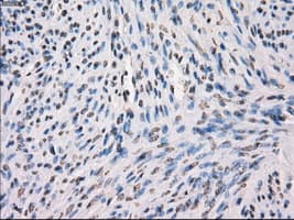 MAP2K1 / MKK1 / MEK1 Antibody (clone OTI1F5)