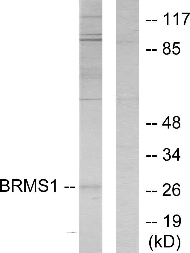 IHC-plus™ BRMS1 Antibody (aa21-70)