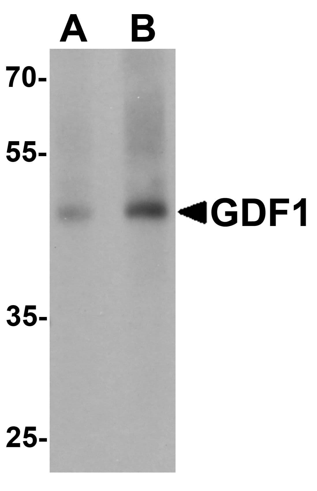 IHC-plus™ GDF1 Antibody