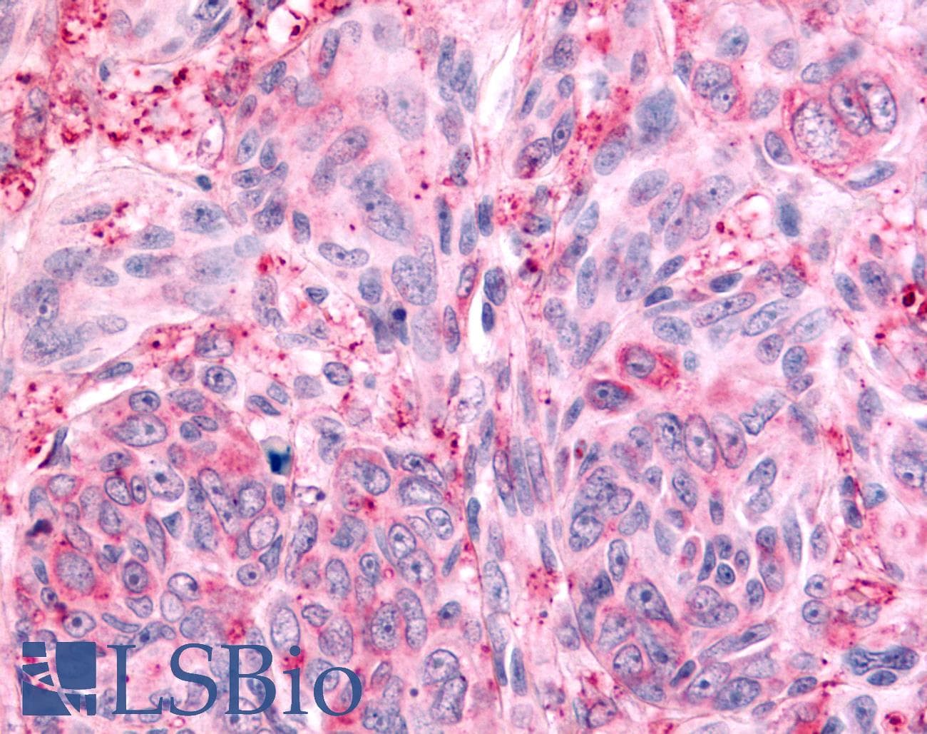 PathPlus™ Polyclonal Rabbit anti-Human PTPRE / PTP Epsilon Antibody (Cytoplasmic Domain, IHC)