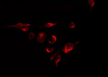 Polyclonal Rabbit anti-Human PPP1R7 Antibody (IF, WB)