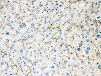 Polyclonal Rabbit anti-Human ABCB11 / BSEP Antibody (IHC, WB)