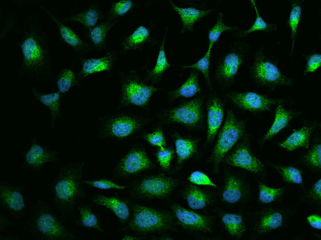 RASSF1 / RASSF1A Antibody