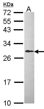IHC-plus™ DCXR Antibody (aa182-244)