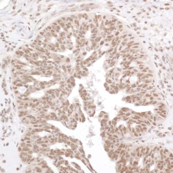 Polyclonal Rabbit anti-Human RELA / NFKB p65 Antibody (phospho-Ser536, IHC, WB)