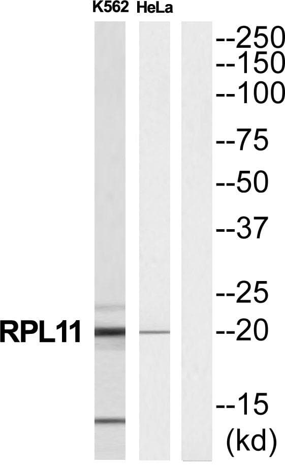 RPL11 / Ribosomal Protein L11 Antibody
