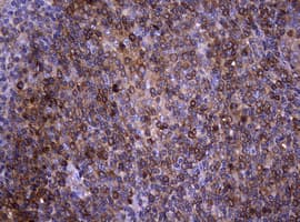 NME1 / NM23 Antibody (clone OTI7E5)