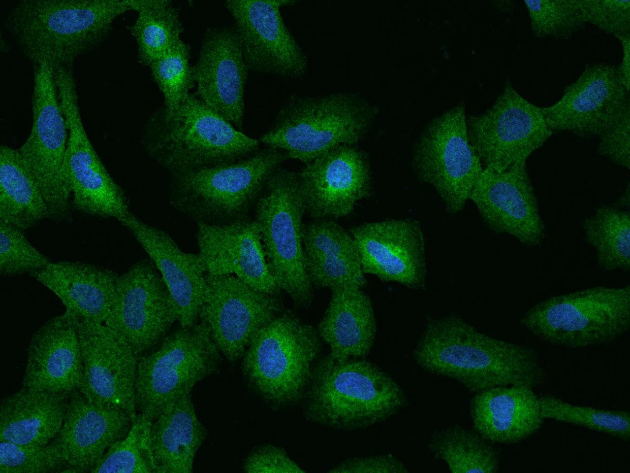 c-CBL Antibody