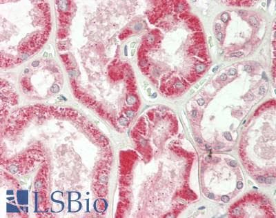 IHC-plus™ SLC22A5 / OCTN2 Antibody