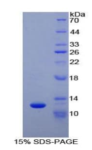 Human CYCS / Cytochrome c Protein (Recombinant His)
