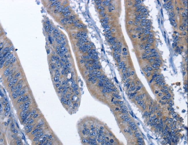 CDK5RAP3 Antibody