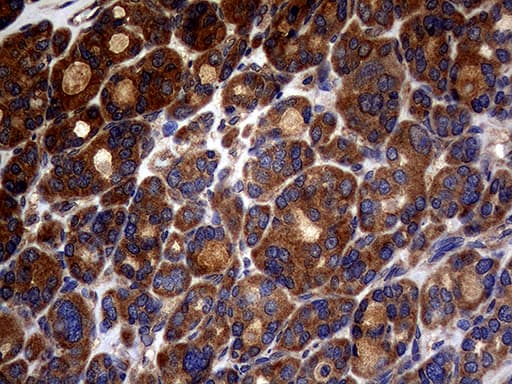 ATG16L1 / ATG16L Antibody (aa1-277, clone OTI5A2)
