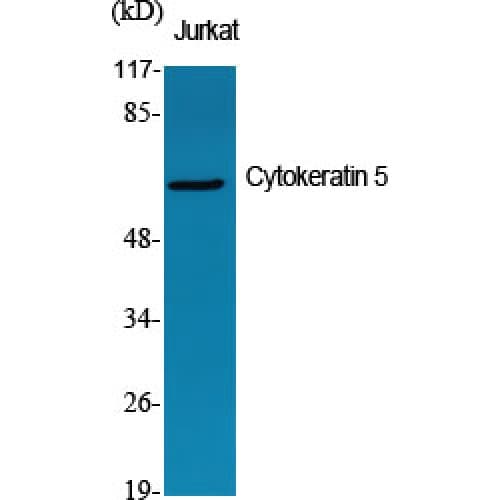PathPlus™ KRT5 / CK5 / Cytokeratin 5 Antibody (510-590 aa, C-terminal)