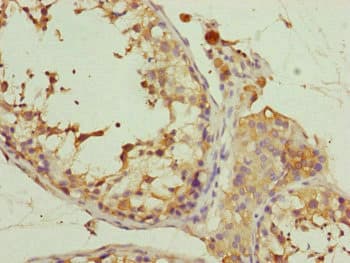 EIF3M / PCID1 Antibody