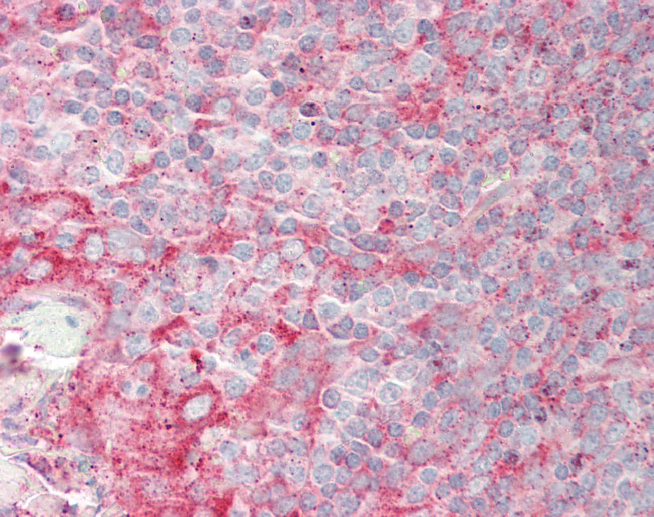 Polyclonal Rabbit anti-Human RNF13 Antibody (aa36-85, IHC, WB)
