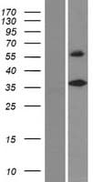 DEGS2 Protein (Over-Expression Lysate Myc-DDK (Flag))