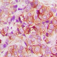 BAX Antibody (N-Terminus)