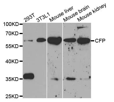 IHC-plus™ Polyclonal Rabbit anti-Human Properdin / CFP Antibody (IHC, IF, WB)