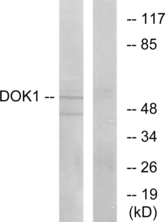 Polyclonal Rabbit anti-Human DOK1 Antibody (aa329-378, IHC, WB)
