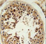 RSPO4 Antibody (aa199-228)