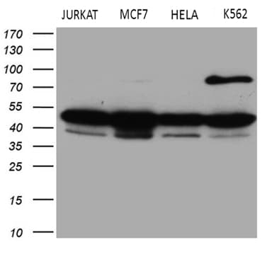 Monoclonal Mouse anti-Human GNAS Antibody (clone OTI13D7, Carrier-free, IHC, WB)