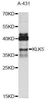 Polyclonal Rabbit anti-Human KLK5 / Kallikrein 5 Antibody (WB)