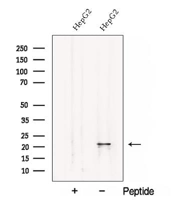 Polyclonal Rabbit anti-Human CSRP2 Antibody (WB)