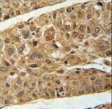 Polyclonal Rabbit anti-Human RTN4IP1 / NIMP Antibody (aa335-363, IHC, WB)