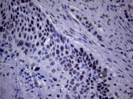 NBN / Nibrin Antibody (clone OTI1F11)