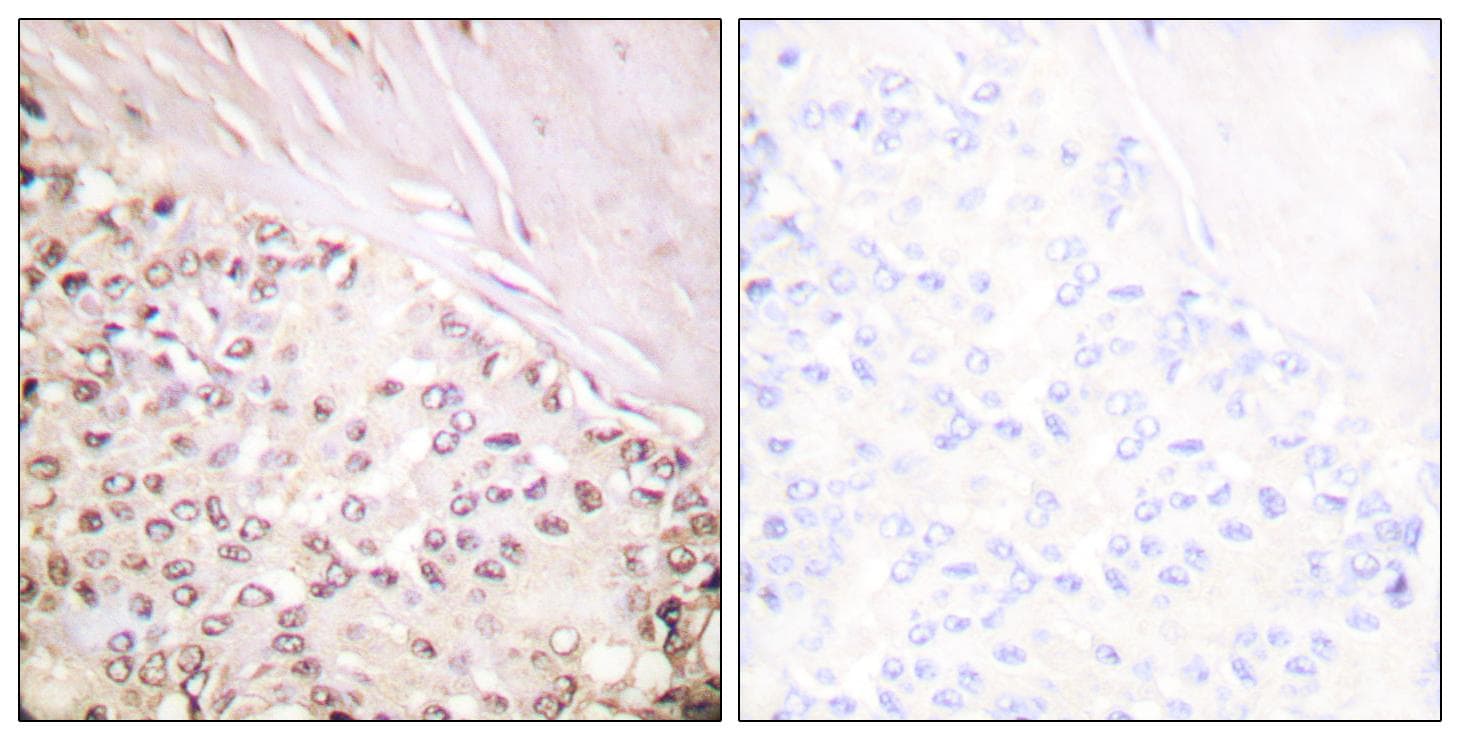 FANCD2 Antibody (p222)