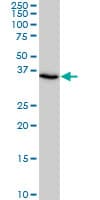IHC-plus™ Monoclonal Mouse anti-Human SMAD3 Antibody (clone 2C12, IHC, WB)