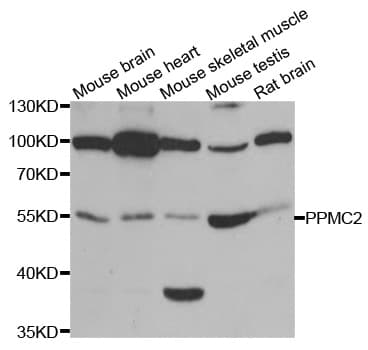 PDP1 Antibody