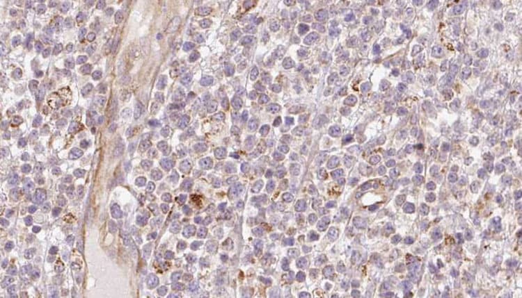 Polyclonal Rabbit anti-Human MIA40 / CHCHD4 Antibody (IHC, IF, WB)