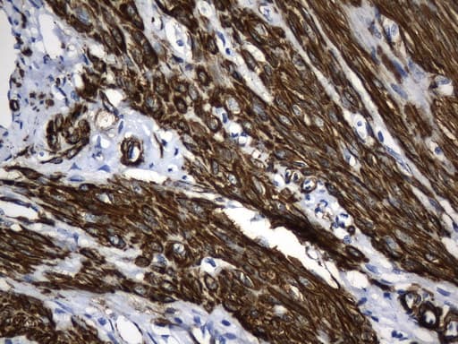 ACTA2 / Smooth Muscle Actin Antibody (N-Terminus, clone UMAB237, Carrier-free)