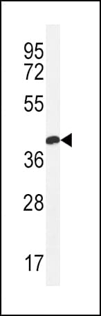 IHC-plus™ CLDN16 / Claudin 16 Antibody (aa6-33)