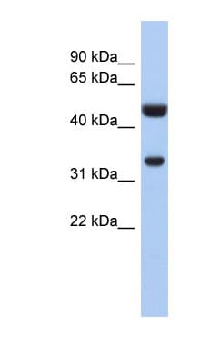 SULT1B1 / Sulfotransferase 1B1 Antibody (aa71-120)