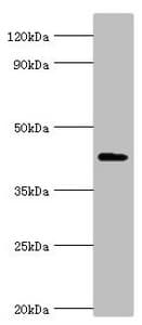 Polyclonal Rabbit anti-Human AIPL1 Antibody (aa1-384, IHC, WB)