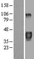 Human ZFP36 / Tristetraprolin Protein (Over-Expression Lysate Myc-DDK (Flag))
