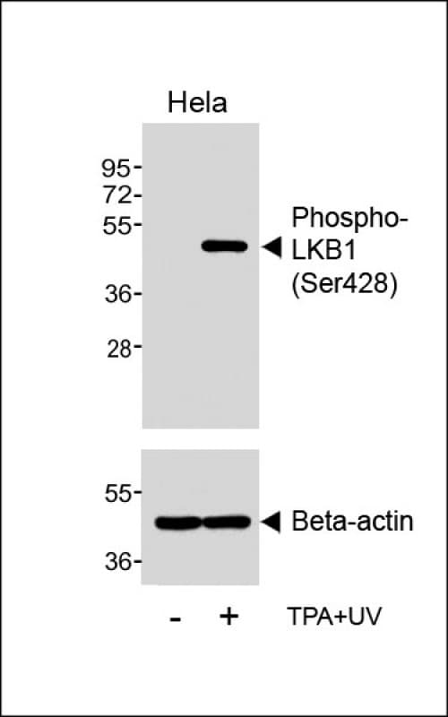 Polyclonal Rabbit anti-Human STK11 / LKB1 Antibody (phospho-Ser428, WB)