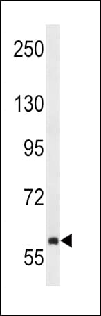 TEC Antibody (aa175-205)