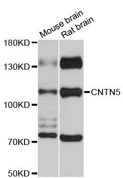 Polyclonal Rabbit anti-Human Contactin-5 / CNTN5 Antibody (WB)