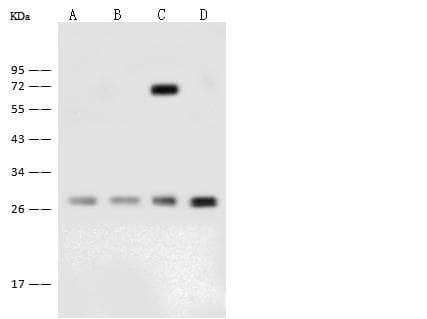 GBAS Antibody