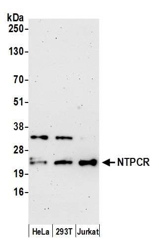 NTPCR / C1orf57 Antibody (aa140-190)