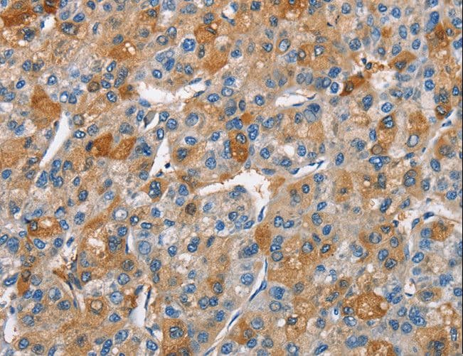 BCL10 / BCL-10 Antibody