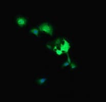 Monoclonal Mouse anti-Human MAP2K3 / MEK3 / MKK3 Antibody (clone OTI5B2, IHC, IF, WB)